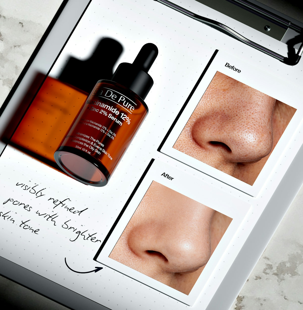 Skincare serum bottle with before and after pore refinement images